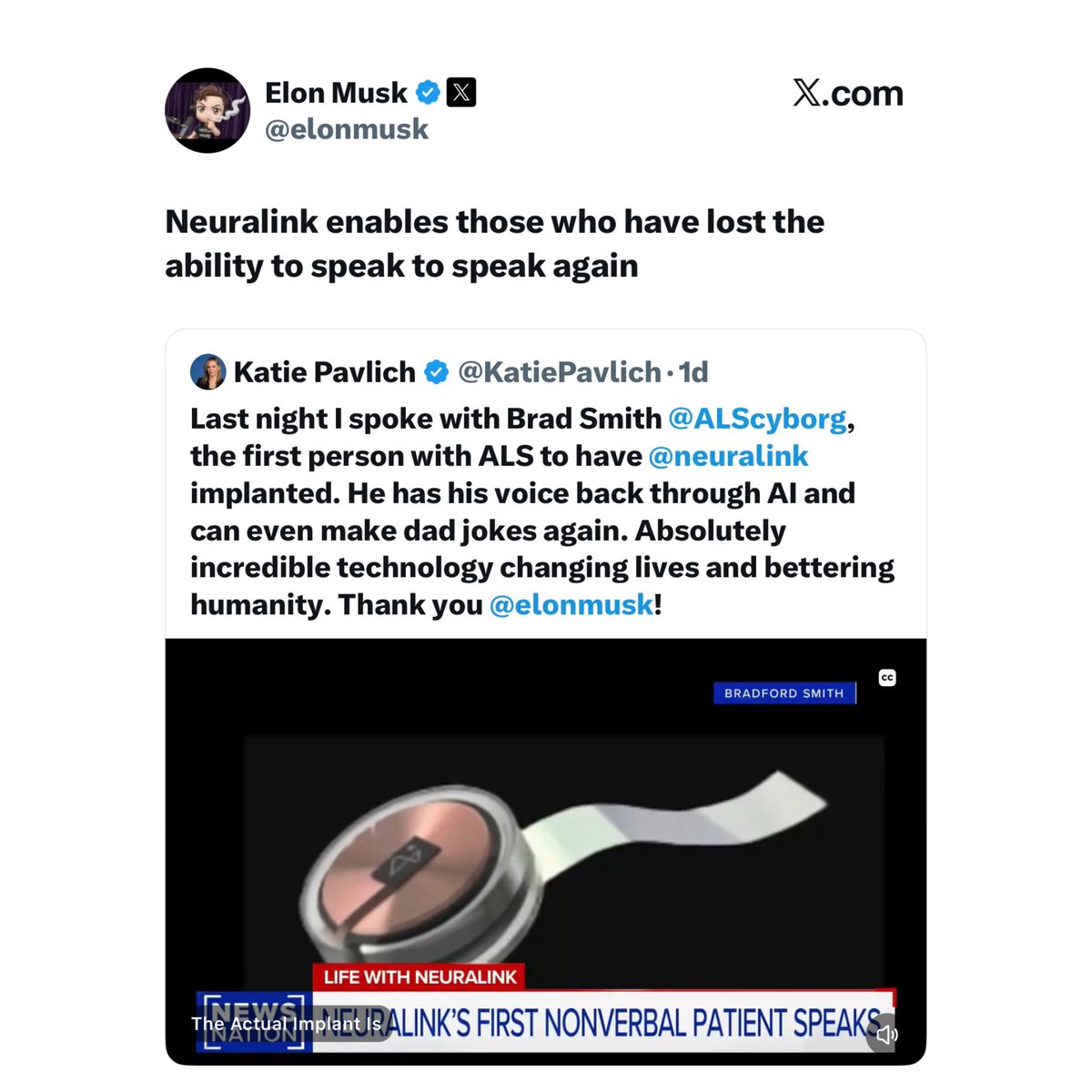 tino_lawrence's tweet image. Thanks to Elonmusk for changing the narrative with  #Neuralink AI technology