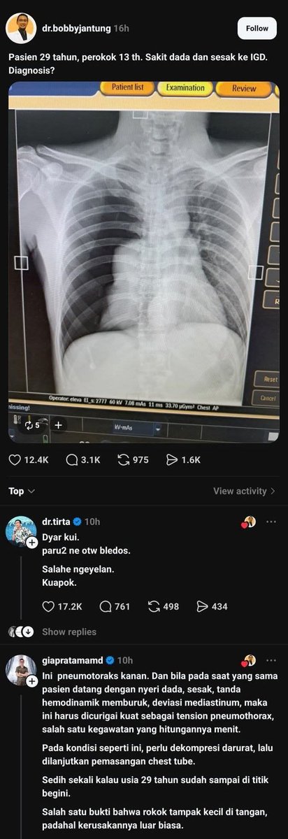 MinDos tweet media
