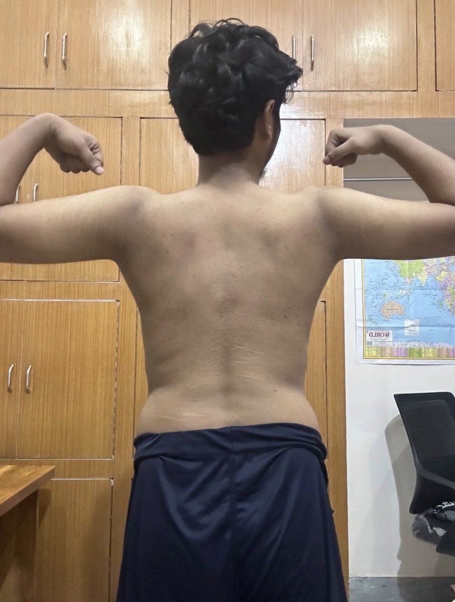 tyagi_in_dev's tweet photo. 6 months can change everything ->if you stay consistent.

Simple rule: 2g protein per kg bodyweight daily. https://t.co/KmFi5JxgCk