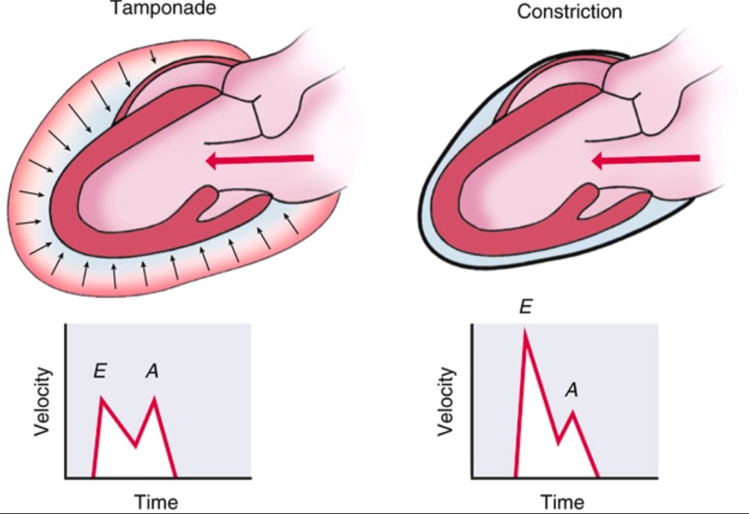 CardiovascularCorner tweet media