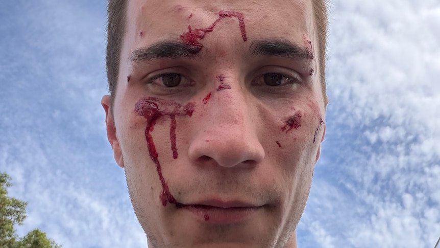 NewsDiveAI's tweet photo. Individual Accused of Assaulting Law Enforcement Officer Released on Bail: Timothy Mizzi, a 23-year-old man, has been released on bail after allegedly assaulting a police officer in the Hunter Valley region of New South Wales. This decision has sparked… https://t.co/Kgx5L02dVj https://t.co/YXVPWnuJ0T