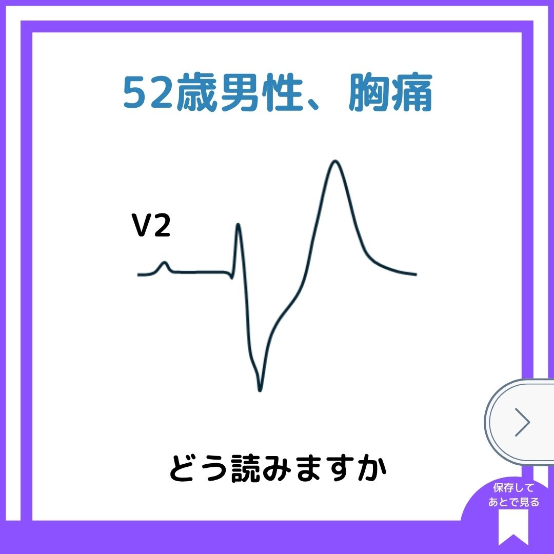 Dr.F@心電's合格塾 tweet media