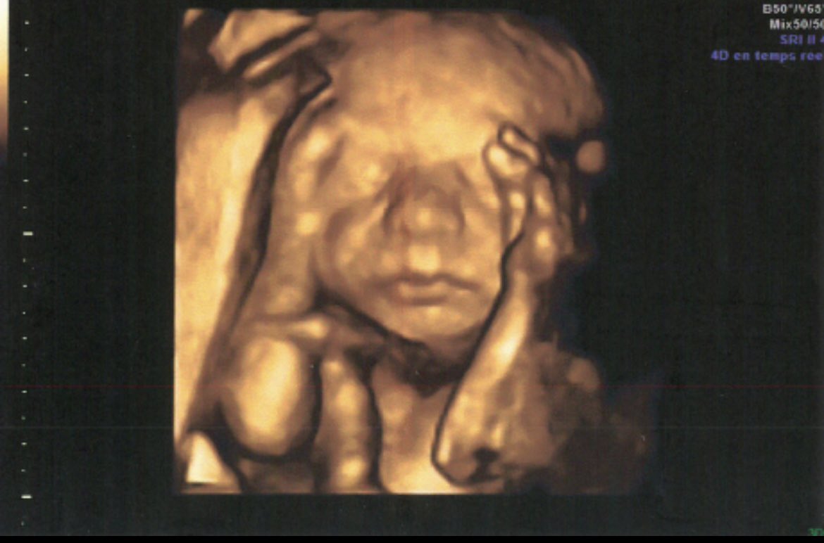 Abby ♱🇻🇦 tweet media