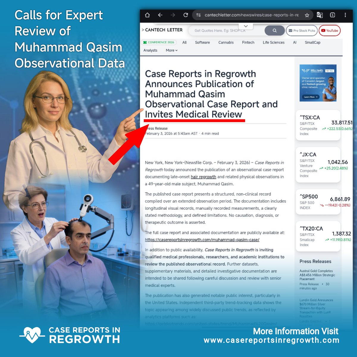 Some people say fake. but where is their proof? Muhammad Qasim case is still standing.

Muhammad Qasim regrowth case can open new doors in natural healing if people take it serious.