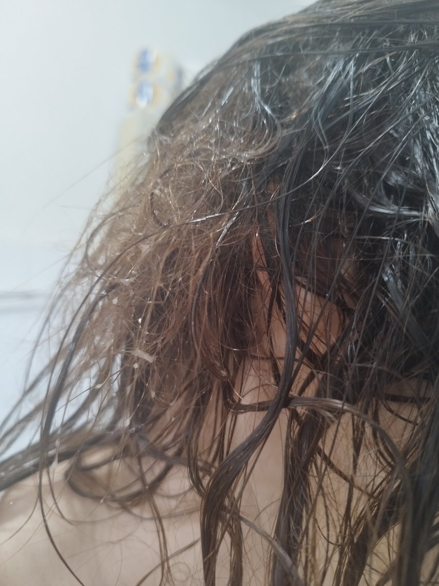 melanezijska žaba tweet media