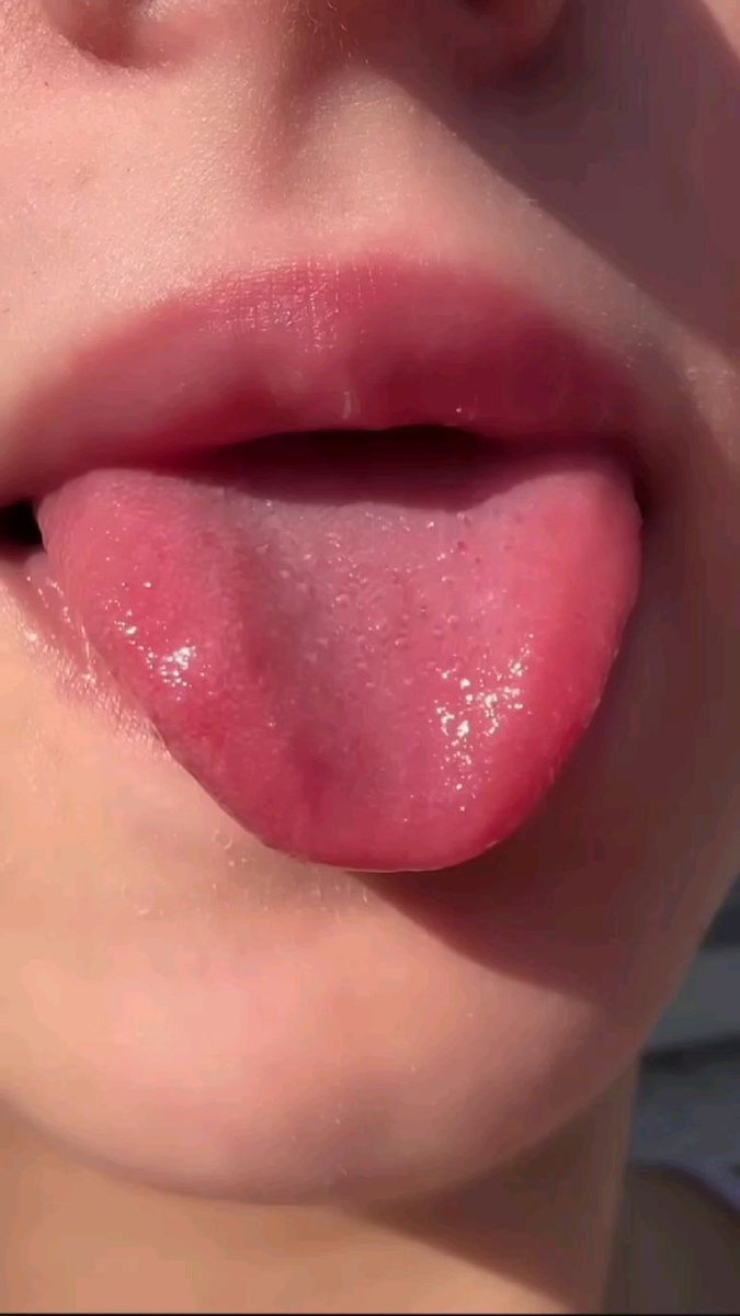 Sissy chocolate🍫🏳️‍⚧️ tweet media