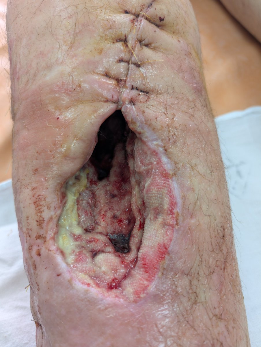 Шхалаха Певучая. tweet media