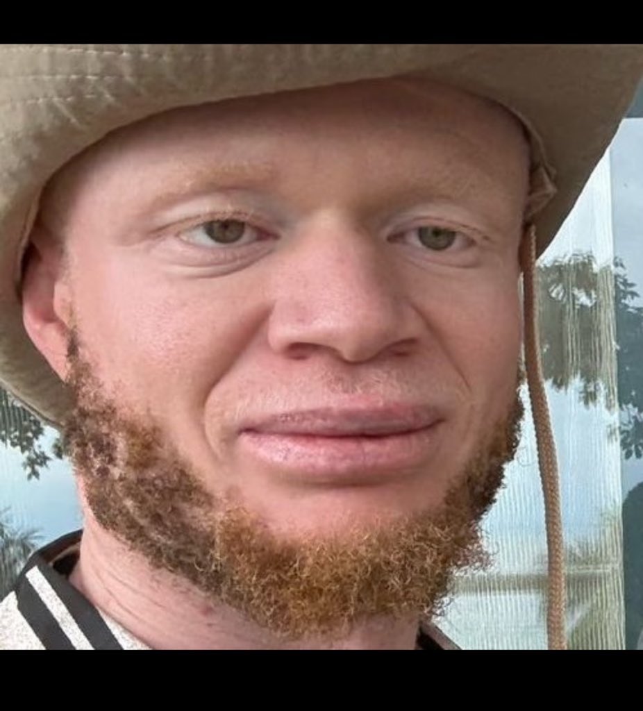 Erwan-Saint'S Le Révérend tweet media