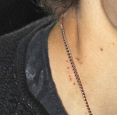 Fandom 2026: "Wait, did he have an accident? What's with his tooth?" 
Directioners: "Please."