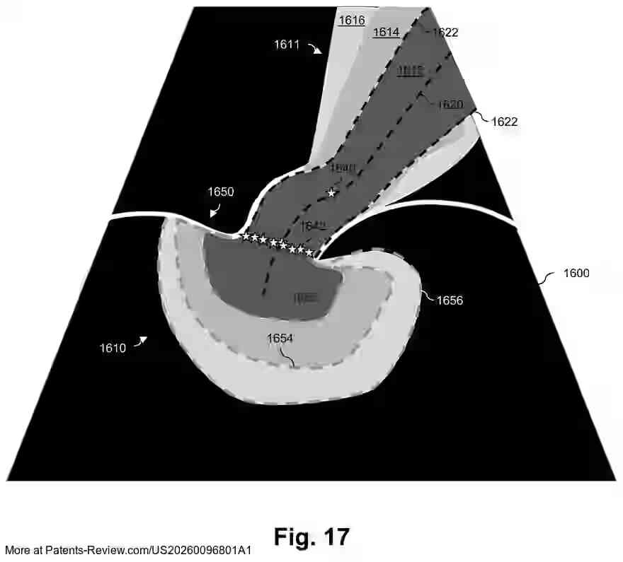 PatentPulse's tweet image. New #patentapplication #US20260096801A1 by #Philips reveals an advanced #ultrasound system for visualizing and quantifying mitral regurgitation.
The system uses a processor circuit to receive B-mode/Doppler data, generate a model of the mitral valve orifice, and display a