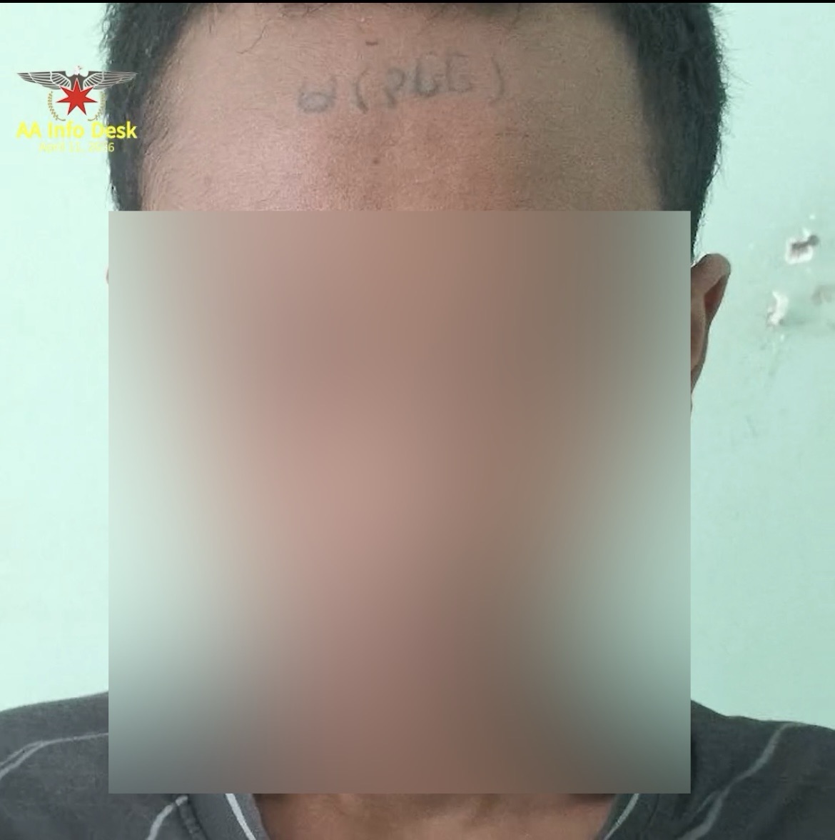 MizzimaNews's tweet image. နေပြည်တော်စစ်တပ်မှ ထွက်ပြေးသည့် စစ်မှုထမ်းလူငယ်များ မျက်နှာတွင် တက်တူးထိုးခံရ 
website link &amp;gt;&amp;gt; bur.mizzima.com/2026/04/12/874…
#စစ်မှုထမ်း
#AA
#လူ့အခွင့်အရေး
#မျက်နှာတက်တူး
#Mizzima