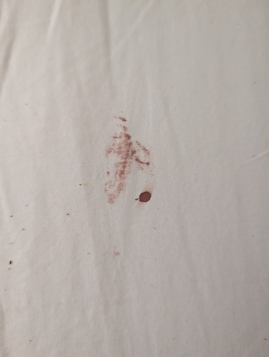 DenesMarton's tweet photo. I HAD A BED BUG INFESTATION IN MY @Airbnb AND THEY DID NOT REFUND ME! 

I reached out, they said I should have told them earlier and I should be grateful the hosts offered to give me 30% off the first night. 

Airbnb has fallen off, a hotel would reimburse 100% and more. https://t.co/Lvx6z8brT7