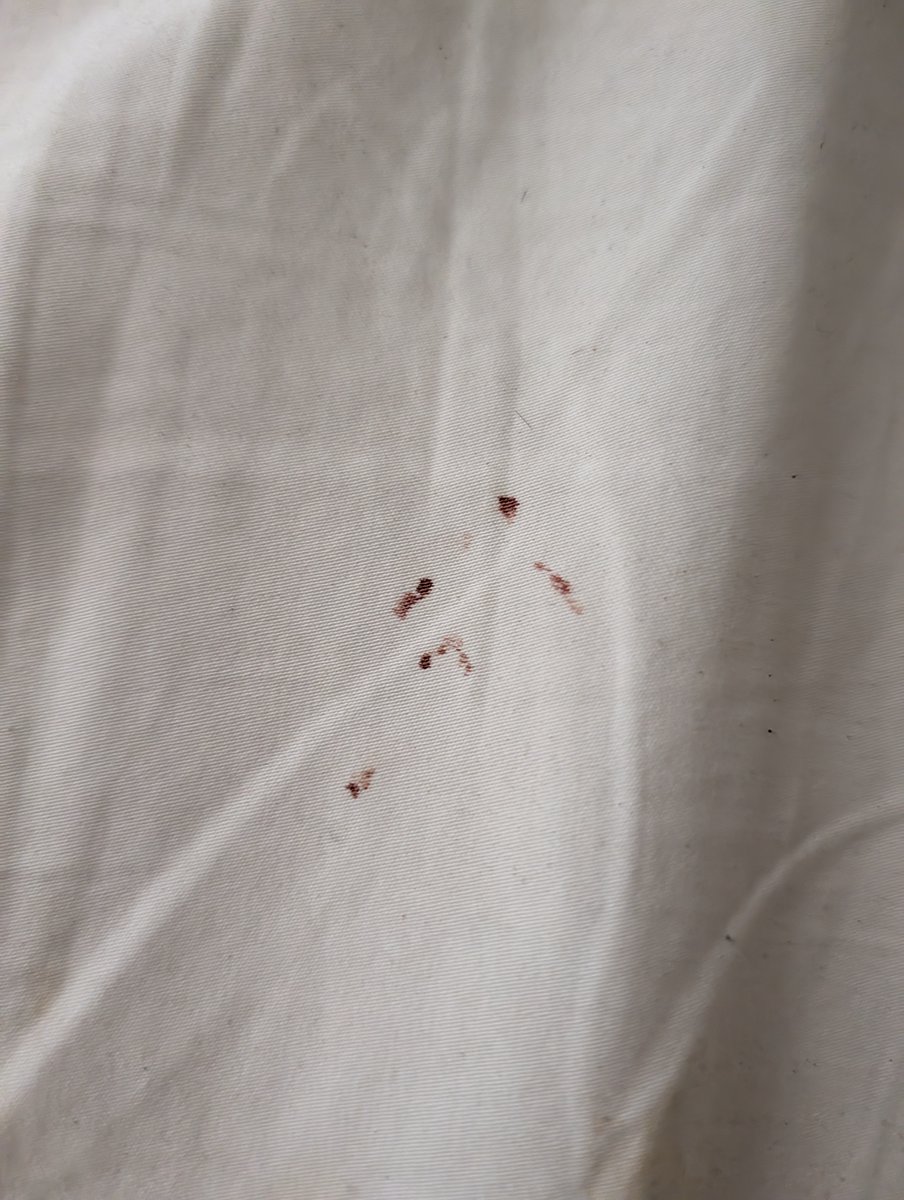 DenesMarton's tweet photo. I HAD A BED BUG INFESTATION IN MY @Airbnb AND THEY DID NOT REFUND ME! 

I reached out, they said I should have told them earlier and I should be grateful the hosts offered to give me 30% off the first night. 

Airbnb has fallen off, a hotel would reimburse 100% and more. https://t.co/Lvx6z8brT7