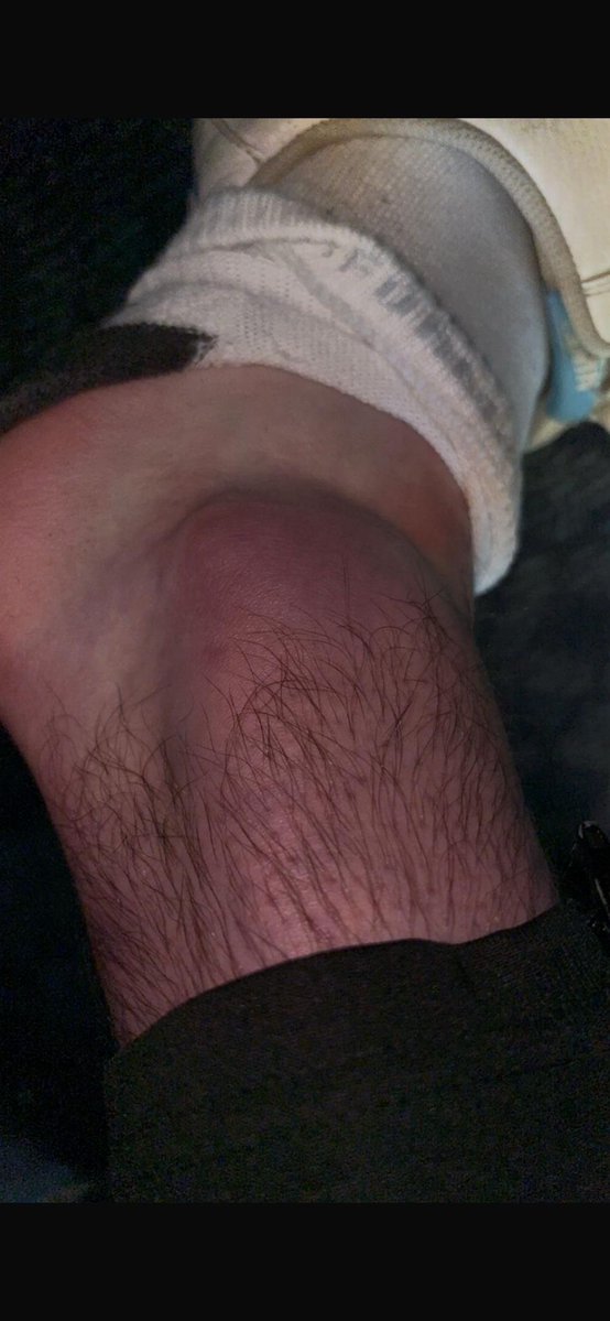 Many thanks to the <a href="/RoyalAlbertWOS/">Royal Albert FC</a> physio for her kind assistance yesterday after our goalkeeper had to go off with a nasty injury midway through the first half

He had a a sore journey home on the train back to Aberdeen and went to A&amp;E without being seen

He is back in today