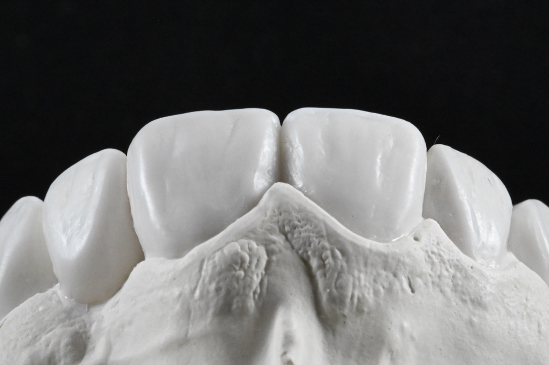 newteethbypro's tweet photo. Chiaroscuro https://t.co/PdConjk0PJ