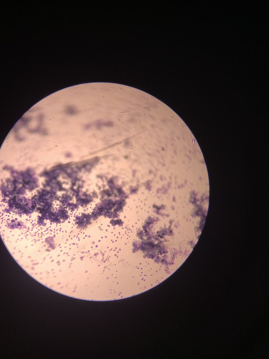 studyvuitton's tweet image. ꒰2️⃣8️⃣꒱ ꒰ 041026 ꒱

cytoPATH(Y)ic effect

꒰ #studytwt #lifetwt #archivetwt #studyLEOgs #lifeLEOgs ꒱