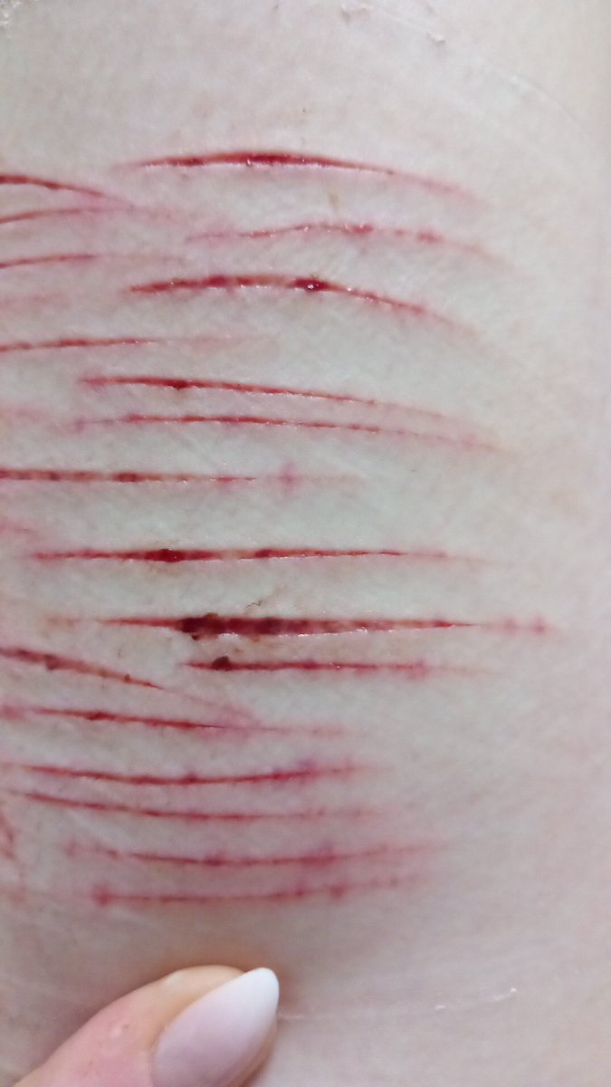 𝒀𝒖𝒓𝒊 𝒐𝒇 𝑺𝒉𝑬𝒅𝑻𝑾𝑻 tweet media