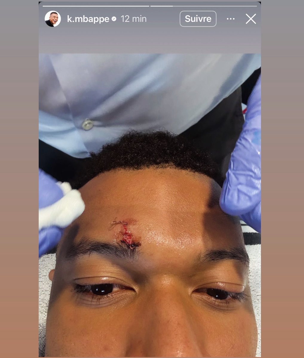 (𝐟𝐚𝐧) 🇵🇹 tweet media