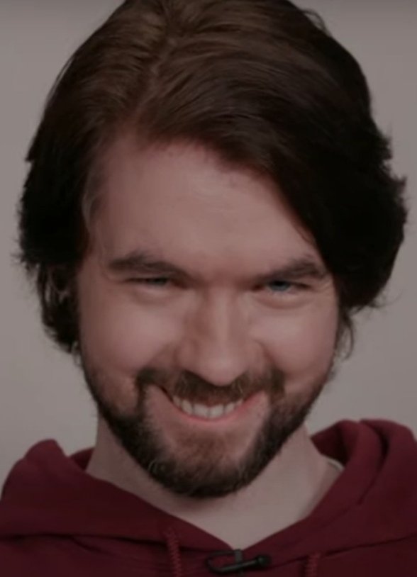 ANTISEPTICEYE (DM ONLY) tweet media