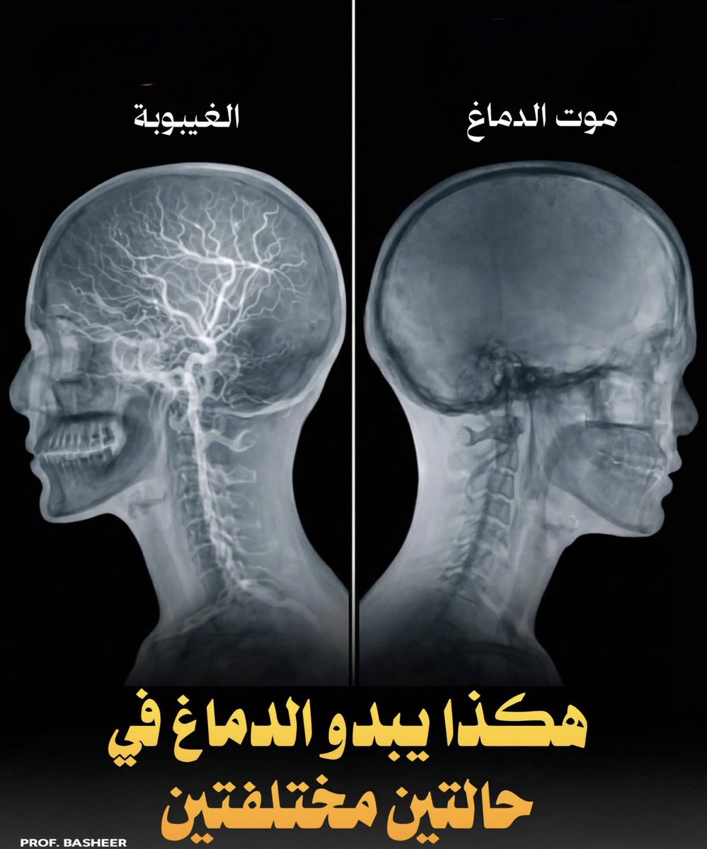 Dr.Saleh A. Alwadie. د.صالح احمد الوادعي tweet media