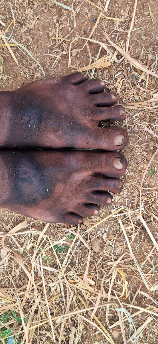 POV: We are putting together stories for the May 2026 issue of On Air, India’s only bilingual webzine on air quality. 

What’s the connection between air quality and these feet of a labourer? We will tell you soon. 

Connect with us: onair@chintan-india.org