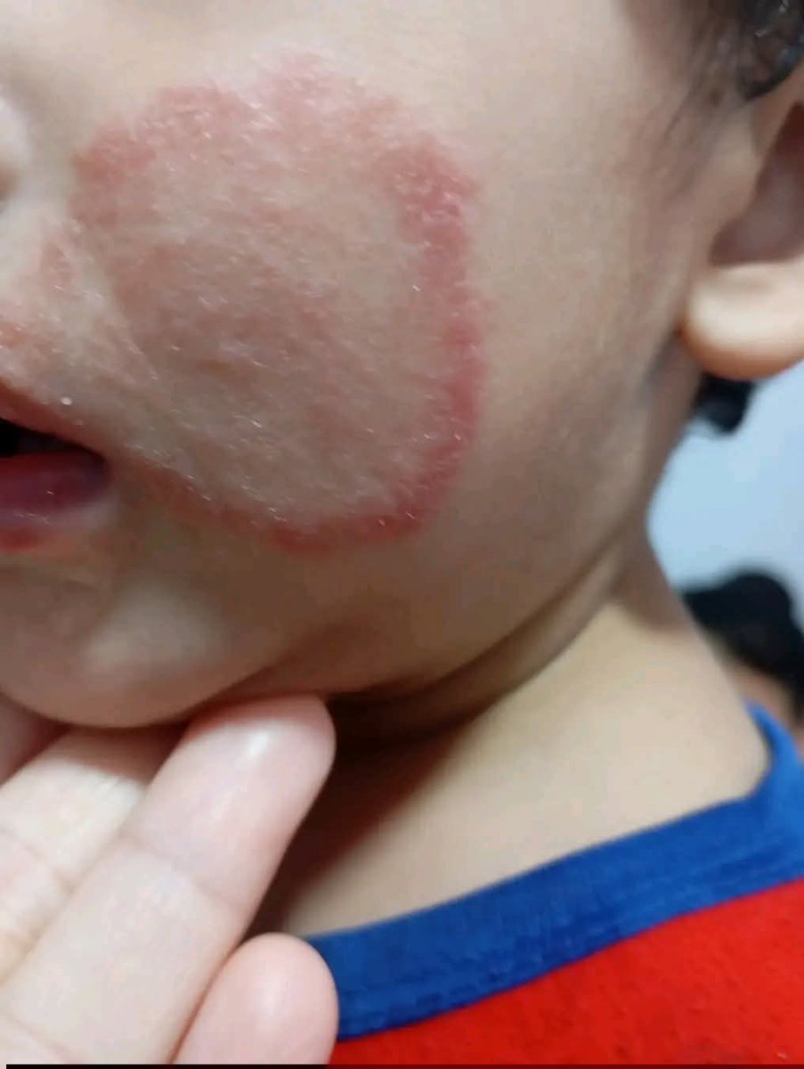 Yousef in Gaza 🇵🇸 tweet media