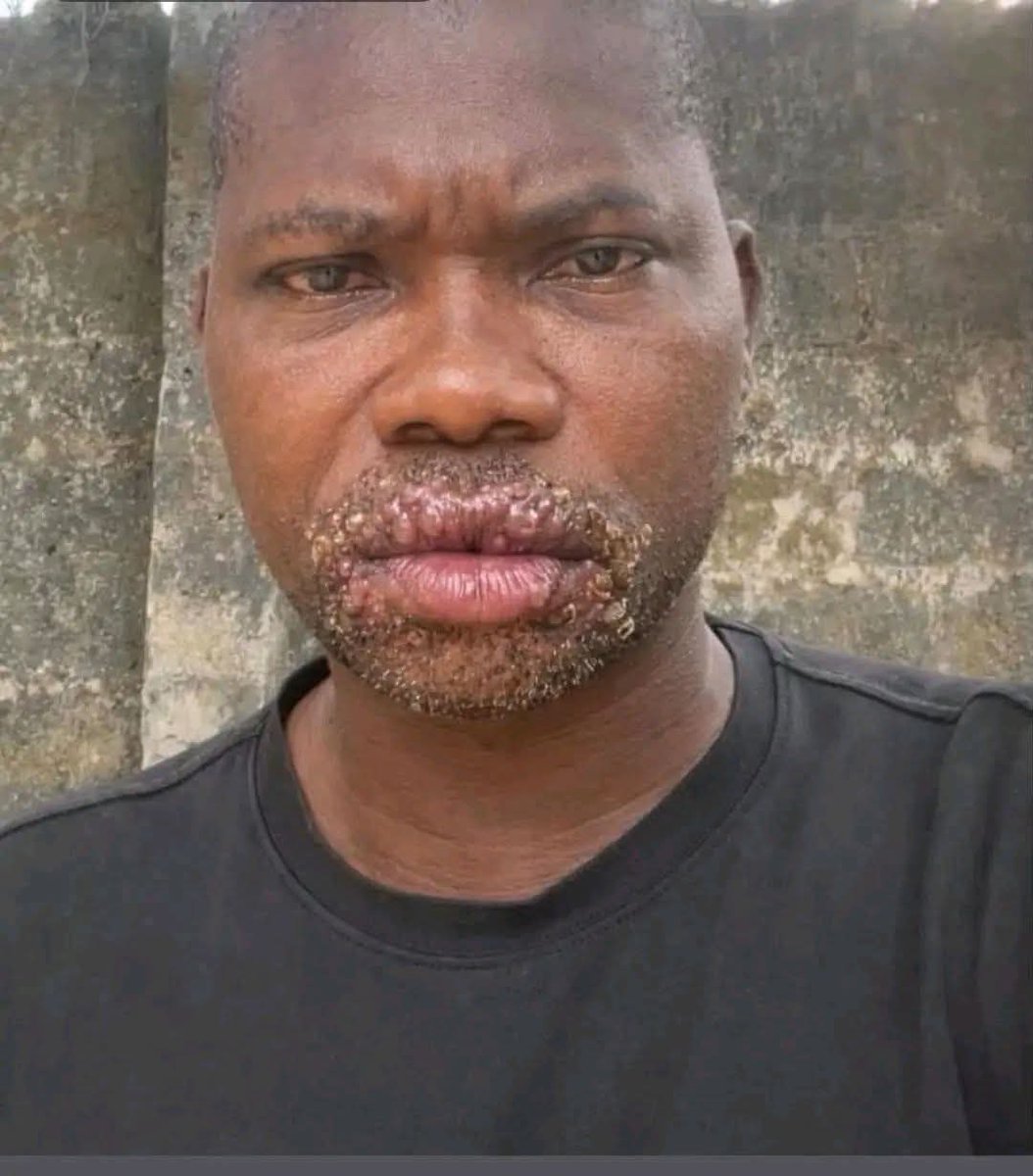 Bekar Sebatindila 🇺🇬 tweet media