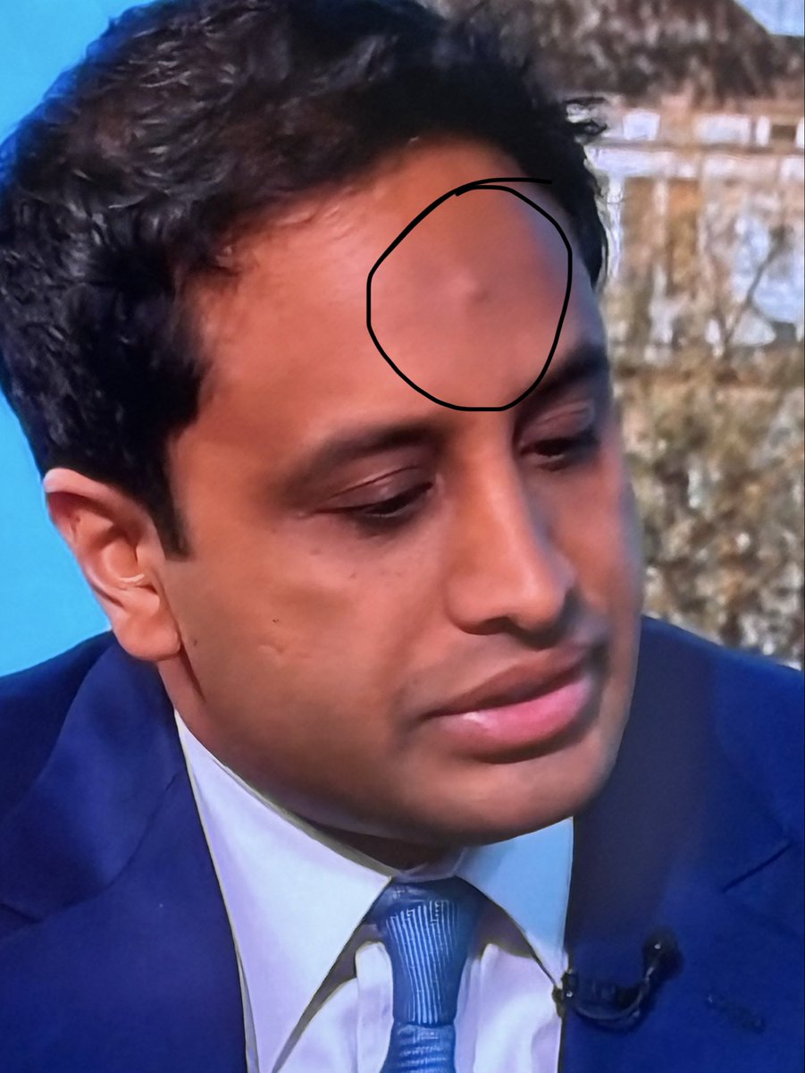 Tina 🩵🏴🇮🇹🐾 tweet media