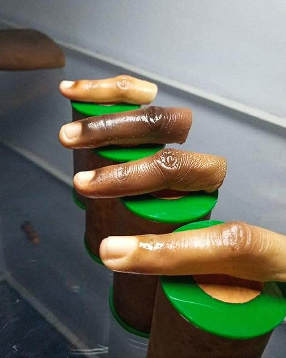 AfricanHub_'s tweet photo. John Amanam is a Nigerian sculptor who makes realistic prosthetics designed for darker skin tones.

His journey started when his brother lost part of his hand and they were unable to find a suitable matching prosthetic, which led him to create one himself.

Through his brand, Immortal Cosmetic Art, he now creates lifelike body parts for clients in Nigeria and other countries.

His work is helping address a significant gap in representation by providing prosthetics that closely match people’s skin tone.