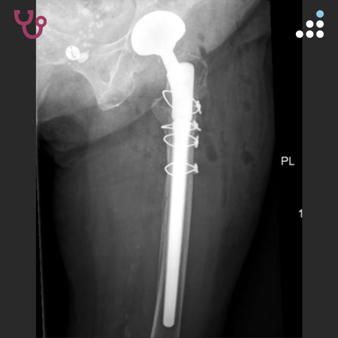 Orthobullets tweet media