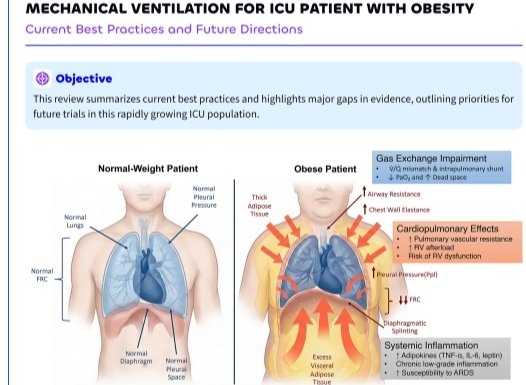 Leo_Santo5's tweet photo. Ventilación Mecánica en Pacientes con Obesidad 🫁🤔

🔰📚Intensive Care Med

https://t.co/ZTwZw4NKd6

Enlace a Artículo Completo👇🏻🆓✅
https://t.co/xumUMHaxVK https://t.co/DddVKCAkc2