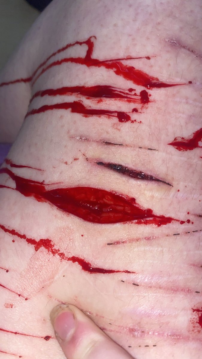 BWMD1019's tweet photo. #shtwt sfx makeup https://t.co/yToW2S5owd