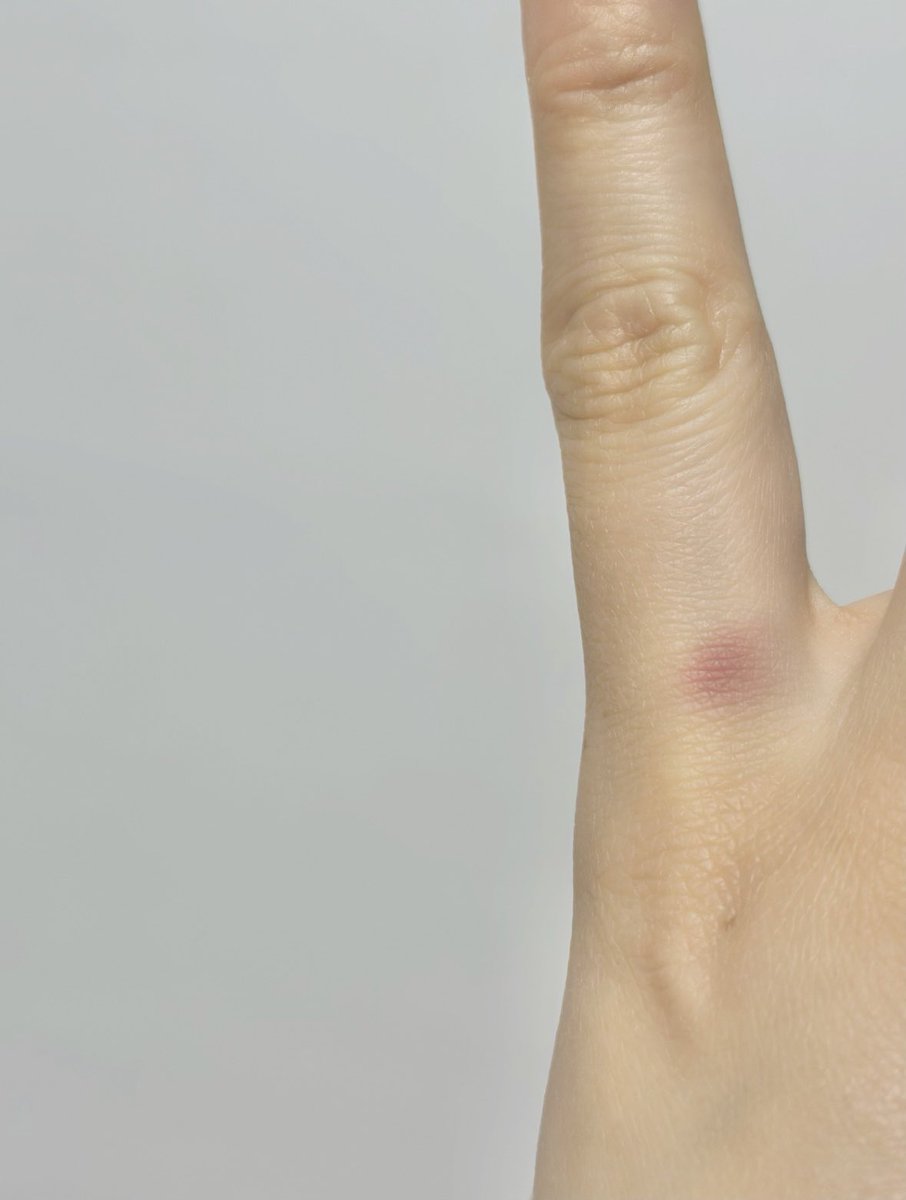 (B11) 노른자 tweet media