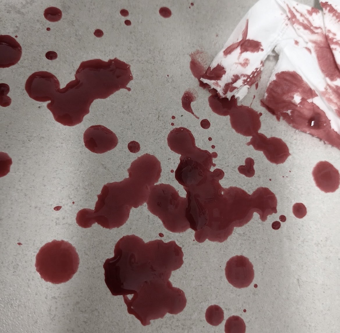 shedtwtdollette's tweet image. Cutsp0 🧵🪡 #cutspo #thread 
‼️ALL MAKEUP‼️
#styrotwt #slittwt #988twt #shtwt #shedtwt #beanstwt #catscratches #slashflashtwt #shed #sh #cut #slit #suicidetwt