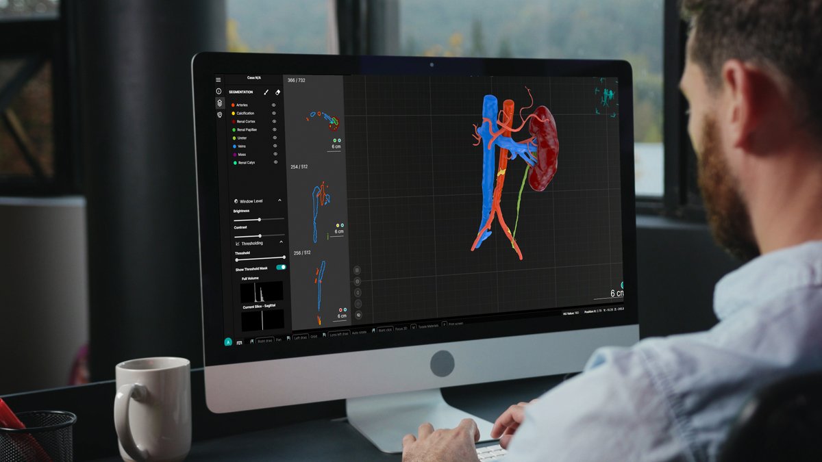 Axial_3D's tweet photo. Robotic precision starts with better anatomy.
We help robotics teams turn medical imaging into accurate, patient-specific 3D data for planning, navigation, and scalable performance.
Better data in. Better precision out.

#SurgicalRobotics #MedicalRobotics #DigitalSurgery https://t.co/EtVXS4ZdKX