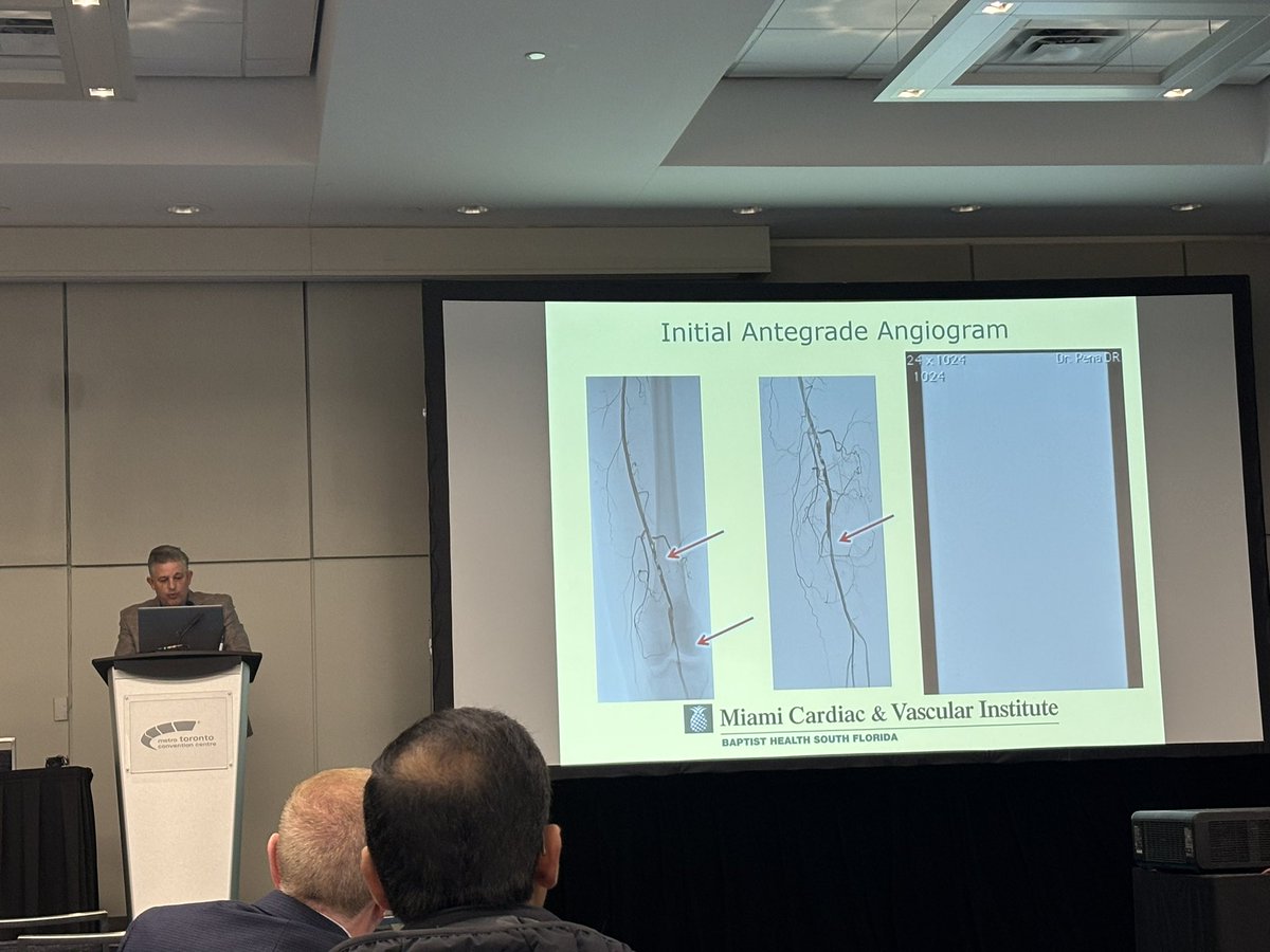 FaizanSwaleh's tweet image. 📸 with: @SDhandMD, @kmadass, Dr. John Rundback, and @docTPlive 

#SIR2026TOR @SIRspecialists @SIRRFS @JVIRmedia #PAD #CLI #CLTI #IRad #Endovascular #GlobalHealth