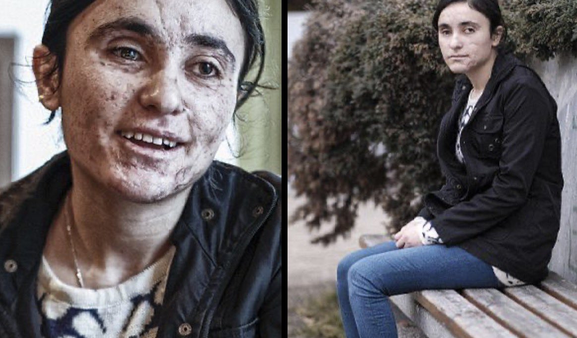 Shukri Hamk tweet media