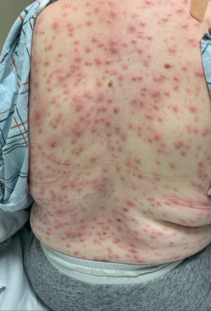 lƐɛ.•º° tweet media