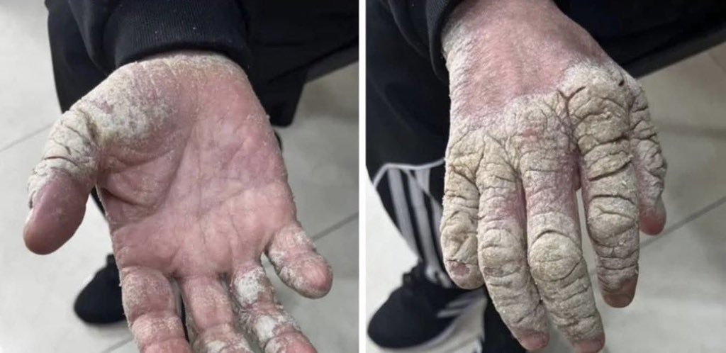 Motasem A Dalloul tweet media