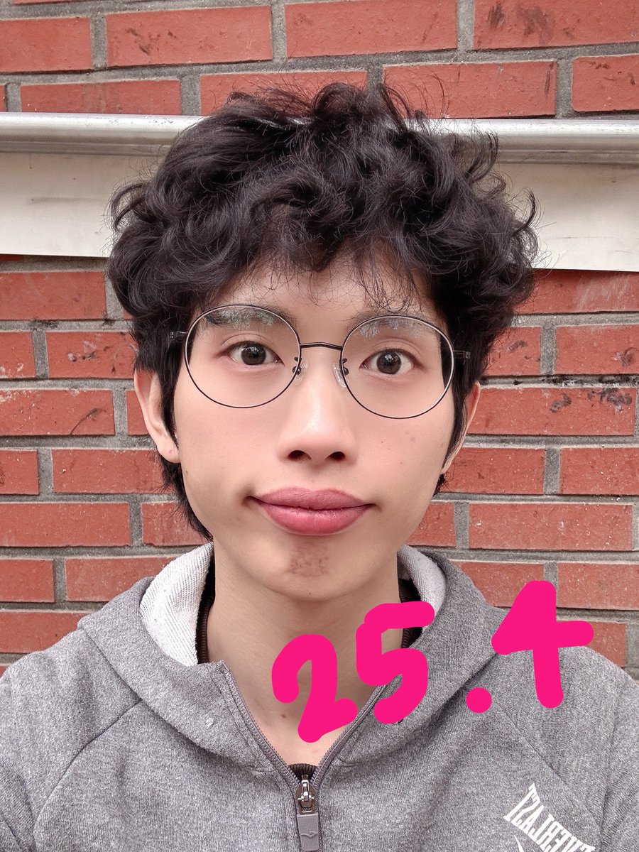 cd_soeuni's tweet photo. 남자가 여성호르몬 투여를 1년동안 한다면?!

2025.04.14 ~ 🏳️‍⚧️ HRT D+365 🩷🎉
새로운 삶을 선택한 지 1년이 되는 날이네요 🥰

사진들은 그동안의 모습 변화입니다 (4개월 주기)
(25년 4월, 25년 8월, 25년 12월, 26년 4월)

-신체 변화 -

가슴: 1.5cm → 9cm (+7.5cm, A컵)
근육량: 30.6kg → 26.9kg (-3.7kg)
몸무게: 53kg → 66kg (+13kg)
체지방률: 9.8% → 25.4% (+15.6%)
남성호르몬: 5.96ng/ml → 0.26ng/ml (-5.7)
여성호르몬: 68.6pg/ml → 252pg/ml (+183.4)
프로락틴 : 12.9ng/ml  → 64.2ng/ml (+51.3)

-그 외 바뀐 것들 -

체모 감소 및 성장 속도 저하, 남성형 체취 사라짐
피부가 부드러워짐, 체온 증가 (특히 손·발)
오한을 자주 느낌, 유즙 분비,
‼️심영이 됨🤭 등

���리는 한달에 1cm 정도 자란듯
대충 길러오다 최근에 층정리후 칼단발

-투약 용량및주기-

25년 4월~ 7월
데포(100%) 2주 1회 , 안드로쿨 1정 일 1회
25년 7월~ 10월
데포(100%) 2주 1회 , 안드로쿨 반정 일 1회
25년 10월 ~ 26년 1월
데포 (80%) 2주 1회 , 안드로쿨 반정 1주 2회
26년 1월 ~ 26년 4월
데포 (80%) 2주 1회 , 안드로쿨 반정 1주 1회

2년차에는 조금더 발전한 모습이 되있기를 🥰

#트랜스젠더 #여성화 #호르몬 #MTF