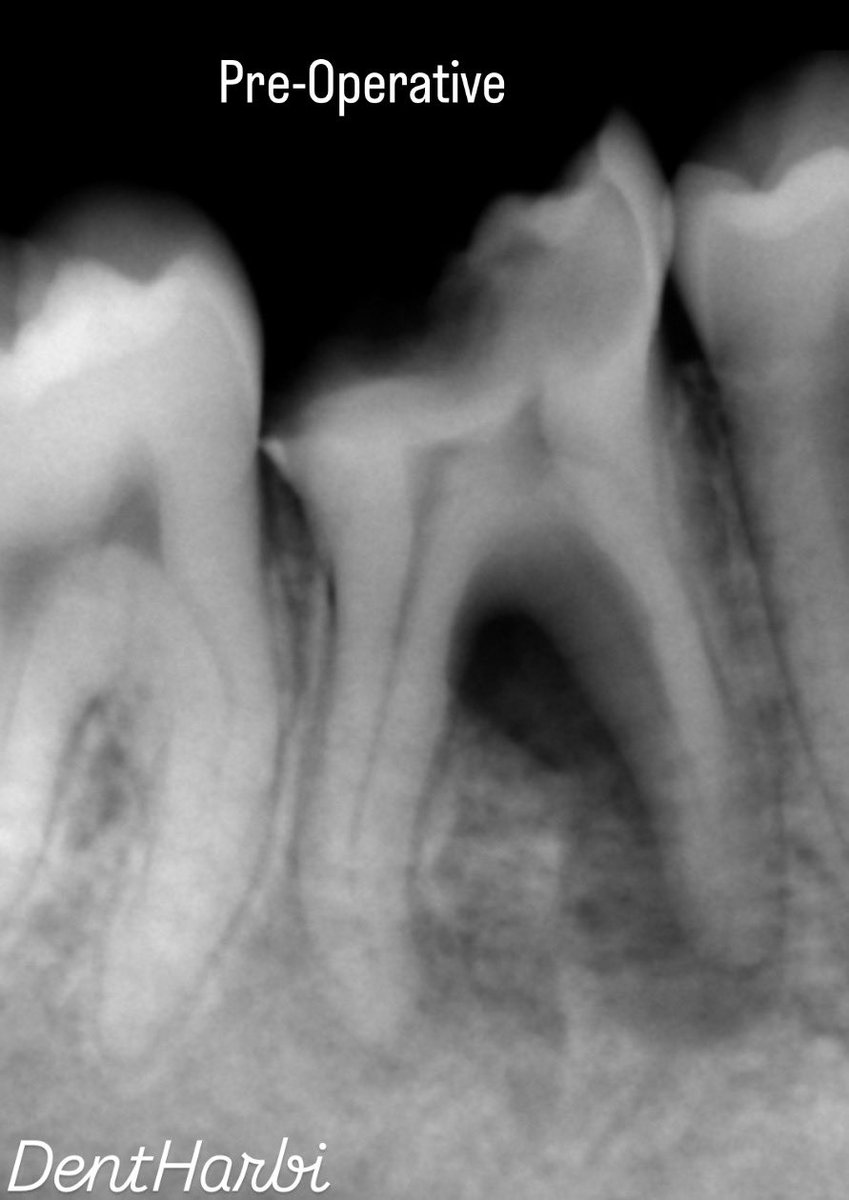 Khalid Alharbi tweet media
