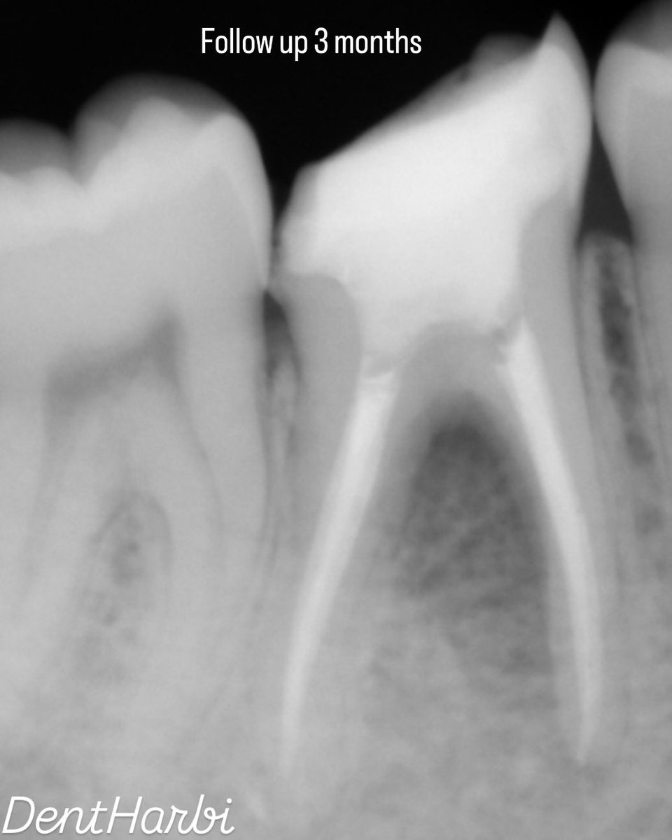 Khalid Alharbi tweet media