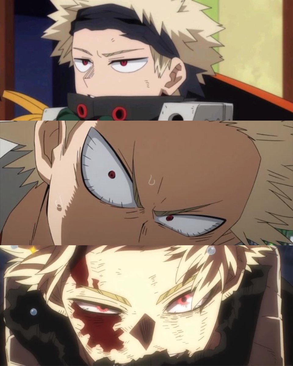 bkgodynamight's tweet photo. katsuki’s forehead deserves to be appreciated https://t.co/wGcDyXapYV