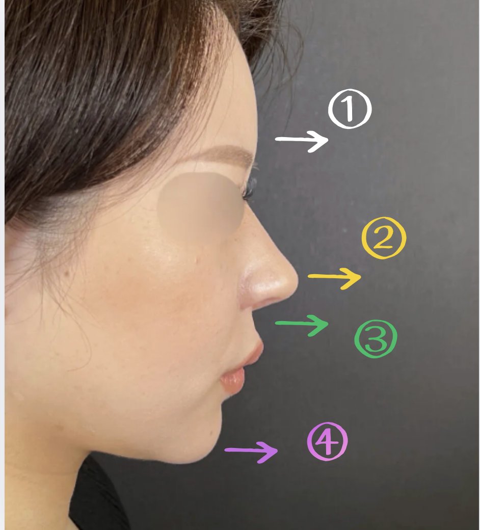 忘れ鼻の美容外科医 Dr小池 tweet media