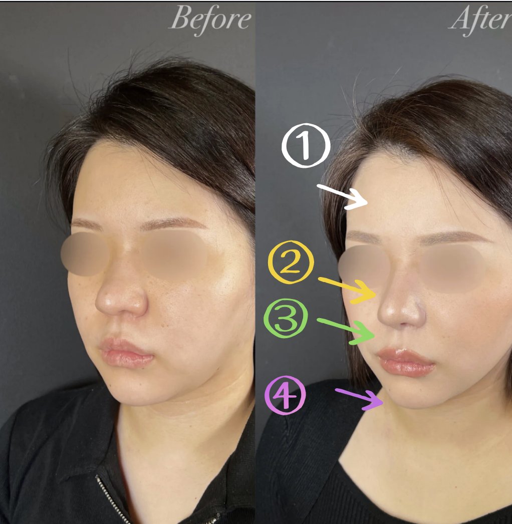 忘れ鼻の美容外科医 Dr小池 tweet media