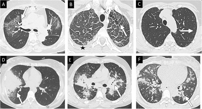 La Revue de Médecine Interne tweet media