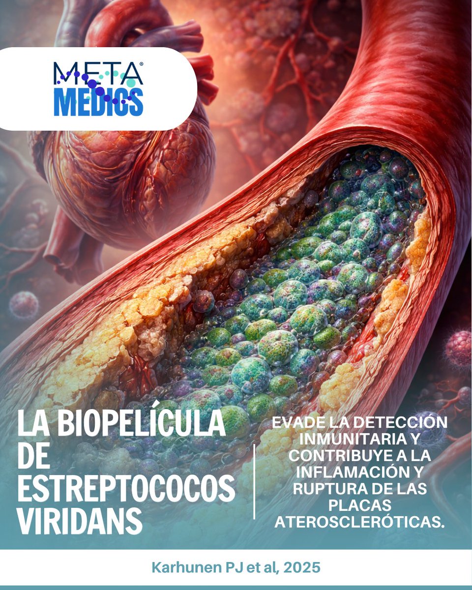 Metamedicsmx's tweet photo. 🦠 Un estudio revela que bacterias orales forman biofilms en placas arteriales, evaden el sistema inmune y podrían desencadenar su ruptura e infartos. La aterosclerosis podría ser también una enfermedad infecciosa. Karhunen PJ et al., 2025. DOI: 10.1161/JAHA.125.041521 https://t.co/4WVuvZL2pG