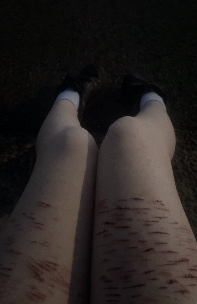 𝚊𝚝𝚜𝚞𝚜𝚑𝚒 𝚘𝚏 𝚜𝚑𝚝𝚠𝚝⋆˚꩜.ᐟ tweet media