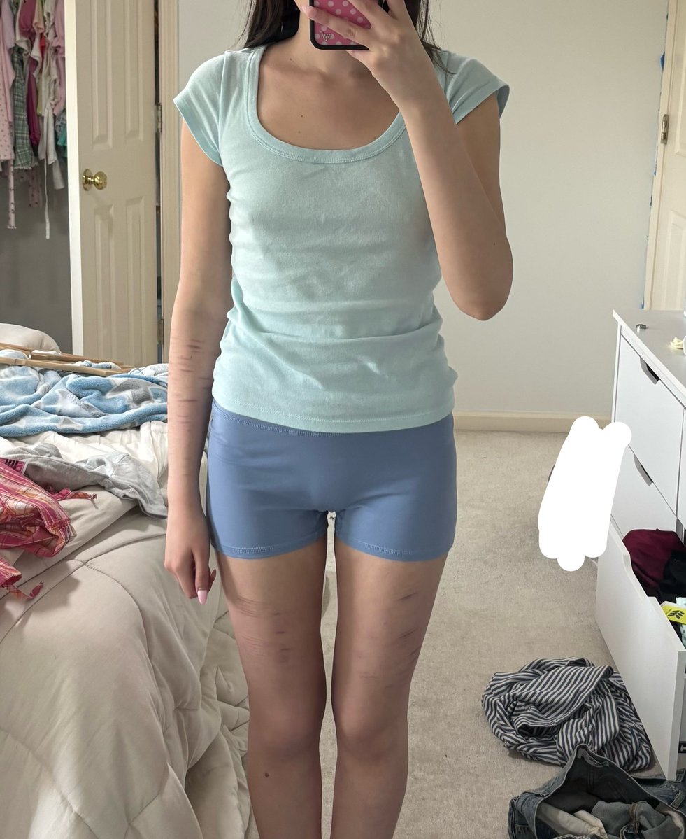 icecreamcat23's tweet image. nothing tastes as good as skinny feels or something like that #edtwt #weightloss #comparisonspo #fatspo