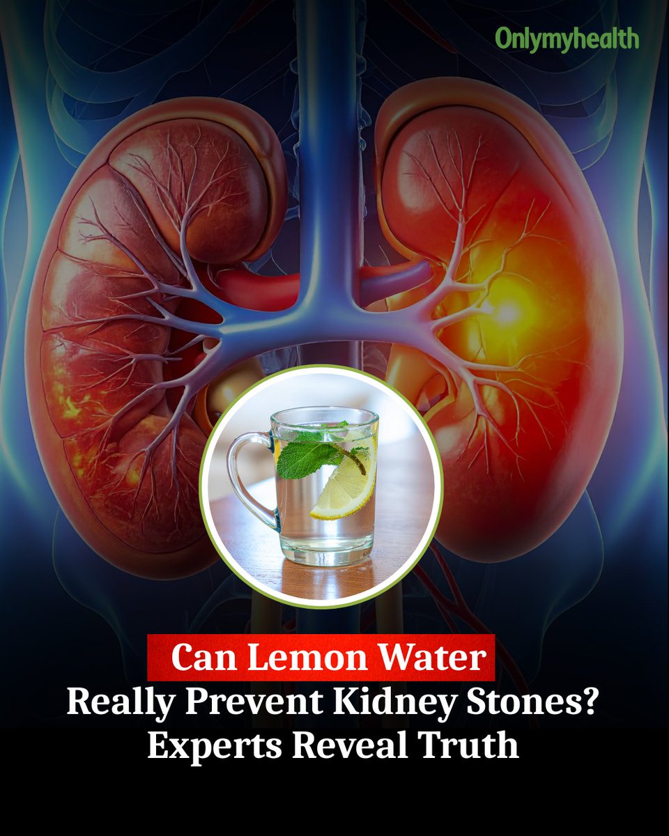 onlymyhealth's tweet image. Starting your day with lemon water? It may help prevent kidney stones 🍋Citrate can reduce risk—but won’t dissolve existing stones. Stay hydrated!#LemonWater #KidneyStones